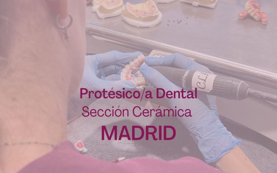 Protésico/a Dental – Sección Cerámica | MADRID