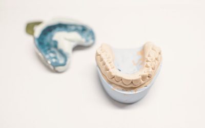 Cómo influye el diseño anatómico en la estética final de una prótesis dental