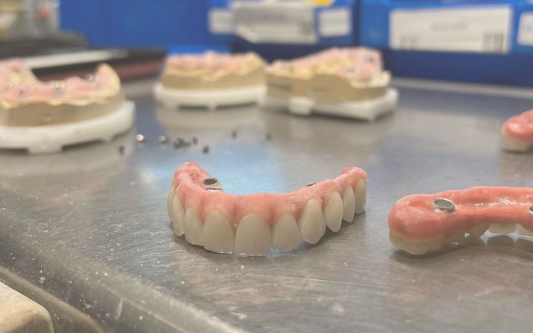Acabado y glaseado dental: la clave para una estética y funcionalidad impecables