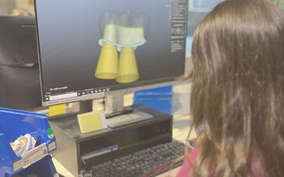 Diseño CAD/CAM: la clave para prótesis dentales precisas y personalizadas