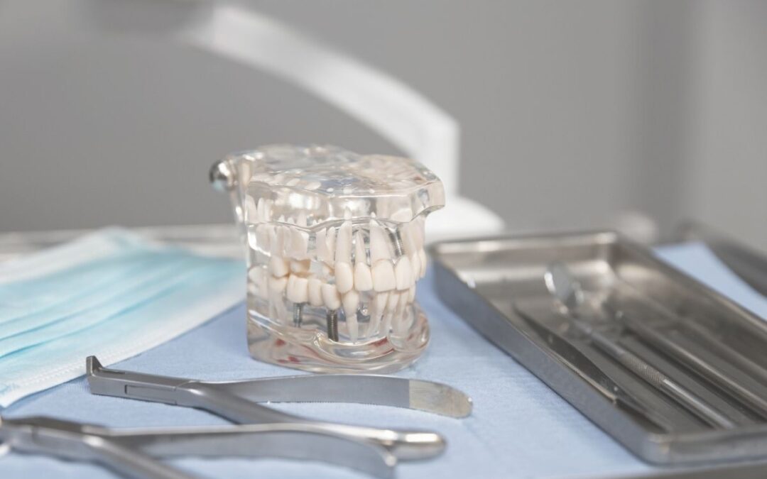 Mantenimiento de las prótesis dentales: por qué la entrega no es el final del tratamiento
