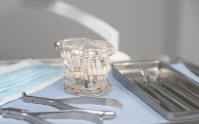Mantenimiento de las prótesis dentales: por qué la entrega no es el final del tratamiento